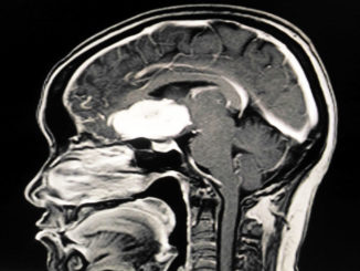 Neurochirurgia-copertina