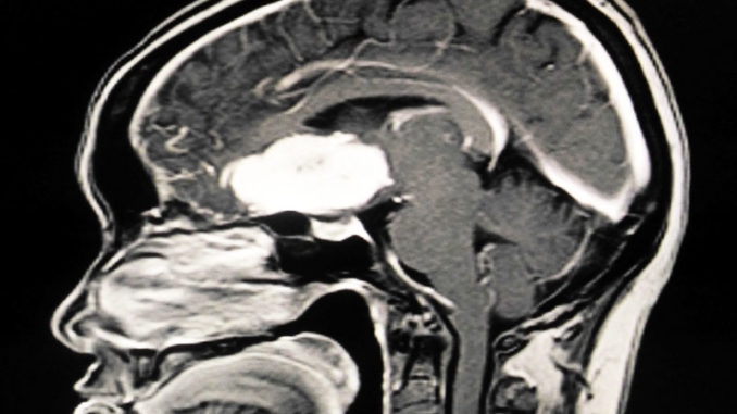 Neurochirurgia-copertina