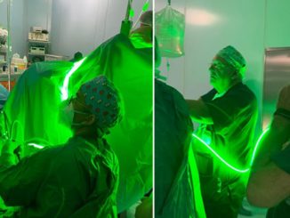 Green-Laser-copertina