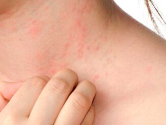 visuels-article6_SS&M4_allergic-cop