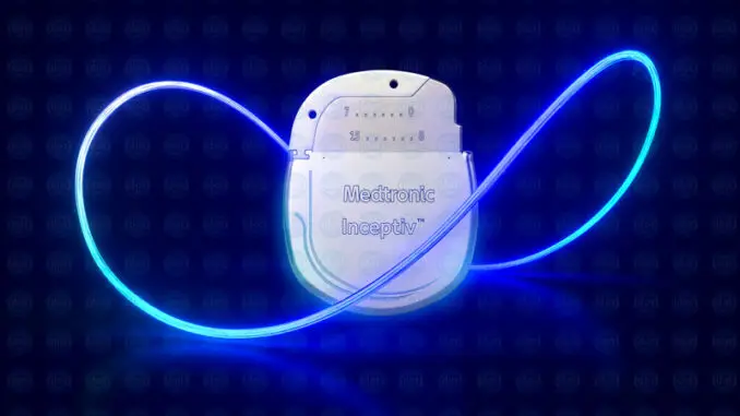 Inceptiv-Neurostomulator-cop